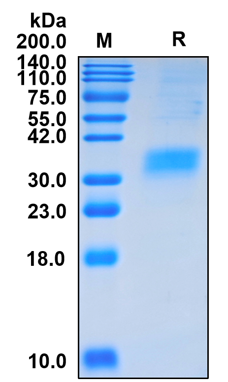 Recombinant Human FOLR1 Protein (ECD, His Tag)